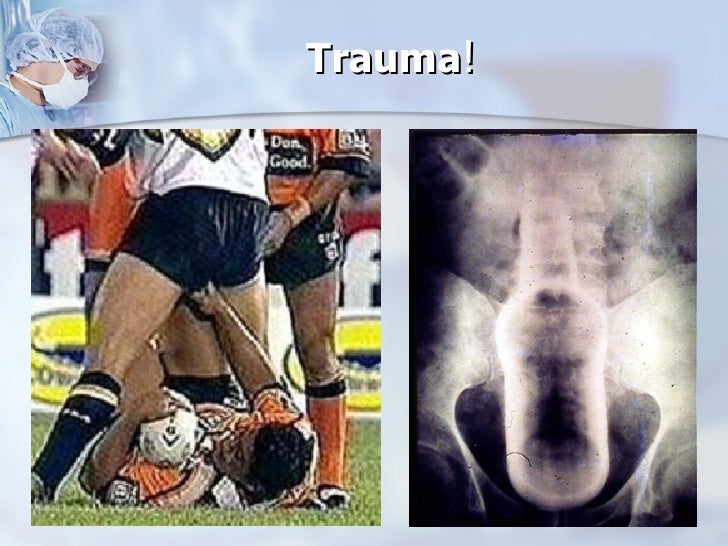 Faecal IncontinencevCauses, Diagnosis, & Contemporary Treatment