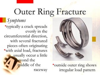 Symptoms
Outer Ring Fracture
•typically a crack spreads
evenly in the
circumferential direction,
with several fractured
pieces often originating
•with axial load, fractures
usually occur a little
beyond the
middle of the
raceway
•outside outer ring shows
irregular load pattern
 