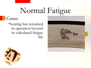 •bearing has remained
in operation beyond
its calculated fatigue
life
Causes
Normal Fatigue
 