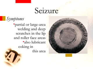 Symptoms
•partial or large-area
welding and deep
scratches in the lip
and roller face areas
•also lubricant
coking in
this area
Seizure
 