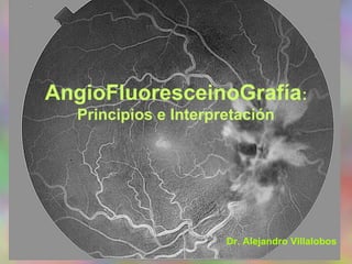 AngioFluoresceinoGrafía: 
Principios e Interpretación 
Dr. Alejandro Villalobos 
 