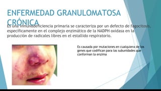 ENFERMEDAD GRANULOMATOSA
CRÓNICAEs una inmunodeficiencia primaria se caracteriza por un defecto de fagocitosis,
específicamente en el complejo enzimático de la NADPH oxidasa en la
producción de radicales libres en el estallido respiratorio.
Es causada por mutaciones en cualquiera de los
genes que codifican para las subunidades que
conforman la enzima
 