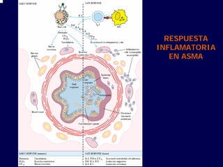 RESPUESTA
INFLAMATORIA
EN ASMA
 