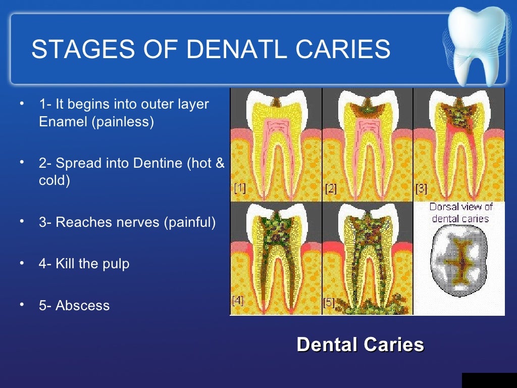 Dental Health Education