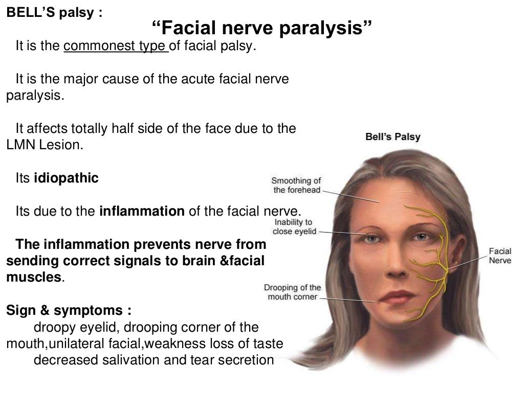 Facial nerve injuries symptoms, treatment