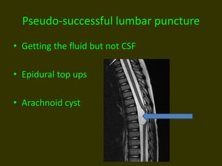Pseudo-successful lumbar puncture
• Getting the fluid but not CSF
• Epidural top ups
• Arachnoid cyst
 