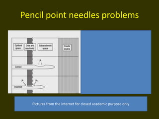 Pencil point needles problems
Pictures from the internet for closed academic purpose only
 