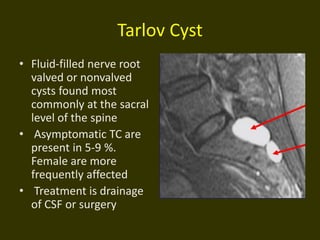 Tarlov Cyst
• Fluid-filled nerve root
valved or nonvalved
cysts found most
commonly at the sacral
level of the spine
• Asymptomatic TC are
present in 5-9 %.
Female are more
frequently affected
• Treatment is drainage
of CSF or surgery
 
