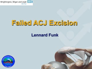 Failed ACJ Excision
     Lennard Funk
 