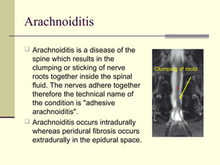 Arachnoiditis

 Arachnoiditis is a disease of the
  spine which results in the
  clumping or sticking of nerve         Clumping of roots
  roots together inside the spinal
  fluid. The nerves adhere together
  therefore the technical name of
  the condition is "adhesive
  arachnoiditis".
 Arachnoiditis occurs intradurally
  whereas peridural fibrosis occurs
  extradurally in the epidural space.
 