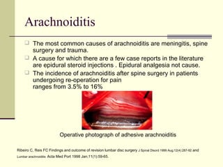 Arachnoiditis
     The most common causes of arachnoiditis are meningitis, spine
      surgery and trauma.
     A cause for which there are a few case reports in the literature
      are epidural steroid injections . Epidural analgesia not cause.
     The incidence of arachnoiditis after spine surgery in patients
      undergoing re-operation for pain
      ranges from 3.5% to 16%




                          Operative photograph of adhesive arachnoiditis

Ribeiro C, Reis FC Findings and outcome of revision lumbar disc surgery J Spinal Disord 1999 Aug;12(4):287-92 and
Lumbar arachnoiditis Acta Med Port 1998 Jan;11(1):59-65.
 