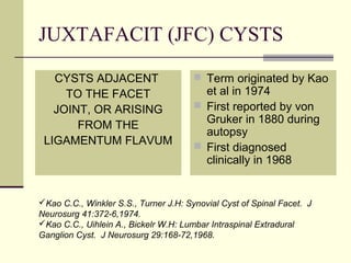 JUXTAFACIT (JFC) CYSTS

   CYSTS ADJACENT                       Term originated by Kao
     TO THE FACET                        et al in 1974
   JOINT, OR ARISING                    First reported by von
                                         Gruker in 1880 during
       FROM THE
                                         autopsy
 LIGAMENTUM FLAVUM                      First diagnosed
                                         clinically in 1968


Kao C.C., Winkler S.S., Turner J.H: Synovial Cyst of Spinal Facet. J
Neurosurg 41:372-6,1974.
Kao C.C., Uihlein A., Bickelr W.H: Lumbar Intraspinal Extradural
Ganglion Cyst. J Neurosurg 29:168-72,1968.
 