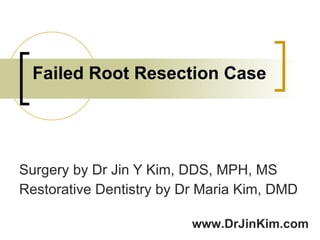 Failed Root Resection Case Surgery by Dr Jin Y Kim, DDS, MPH, MS Restorative Dentistry by Dr Maria Kim, DMD www.DrJinKim.com 