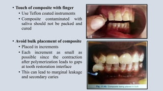 • Touch of composite with finger
• Use Teflon coated instruments
• Composite contaminated with
saliva should not be packed and
cured
• Avoid bulk placement of composite
• Placed in increments
• Each increment as small as
possible since the contraction
after polymerization leads to gaps
at tooth restoration interface
• This can lead to marginal leakage
and secondary caries
 