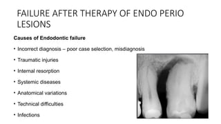 failure in Periodontal Therapy - Dr Smijal Gopalan Marath - Specialist ...