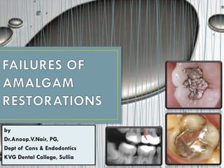 by
Dr.Anoop.V.Nair, PG,
Dept of Cons & Endodontics
KVG Dental College, Sullia
 