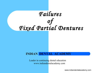 FailuresFailures
ofof
Fixed Partial DenturesFixed Partial Dentures
INDIAN DENTAL ACADEMY
Leader in continuing dental education
www.indiandentalacademy.com
www.indiandentalacademy.com
 