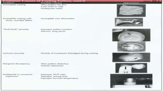 REFERENCES
• Fundamentals of fixed prosthodontics-
Herbert T. Shillingburg
• Dental laboratory procedures – FPD
kenneth D....