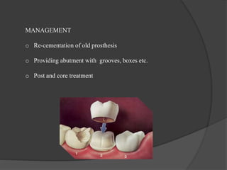 MANAGEMENT
o Re-cementation of old prosthesis
o Providing abutment with grooves, boxes etc.
o Post and core treatment
 