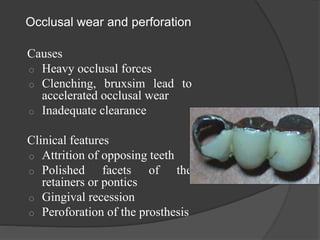Occlusal wear and perforation
Causes
o Heavy occlusal forces
o Clenching, bruxsim lead to
accelerated occlusal wear
o Inadequate clearance
Clinical features
o Attrition of opposing teeth
o Polished facets of the
retainers or pontics
o Gingival recession
o Peroforation of the prosthesis
 