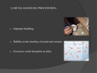 3) METAL HANDLING PROCEDURES:-
o Improper handling
o Bubbles at the interface of metal and ceramic
o Excessive oxide formation on alloy
 