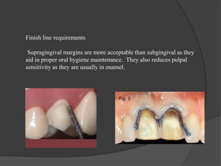Finish line requirements
Supragingival margins are more acceptable than subgingival as they
aid in proper oral hygiene maintenance. They also reduces pulpal
sensitivity as they are usually in enamel.
 