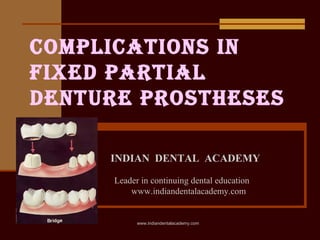 COMPLICATIONS IN
FIXED PARTIAL
DENTURE PROSTHESES
INDIAN DENTAL ACADEMY
Leader in continuing dental education
www.indiandentalacademy.com
www.indiandentalacademy.com
 