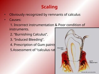 Calculus Failure causes of failures in Periodontal therapy.ppt