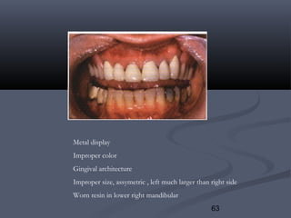 63
Metal display
Improper color
Gingival architecture
Improper size, assymetric , left much larger than right side
Worn resin in lower right mandibular
 