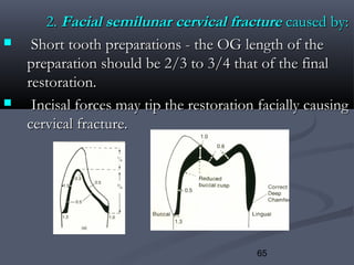 65
2.2. Facial semilunarFacial semilunar cervical fracturecervical fracture caused by:caused by:
 Short tooth preparations - the OG length of theShort tooth preparations - the OG length of the
preparation should be 2/3 to 3/4 that of the finalpreparation should be 2/3 to 3/4 that of the final
restoration.restoration.
 Incisal forces may tip the restoration facially causingIncisal forces may tip the restoration facially causing
cervical fracture.cervical fracture.
 