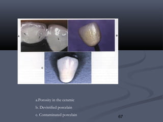 67
a.Porosity in the ceramic
b. Devitrified porcelain
c. Contaminated porcelain
 