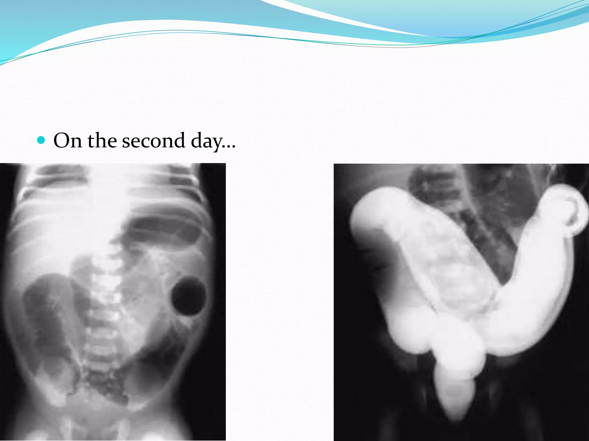  On the second day…
 