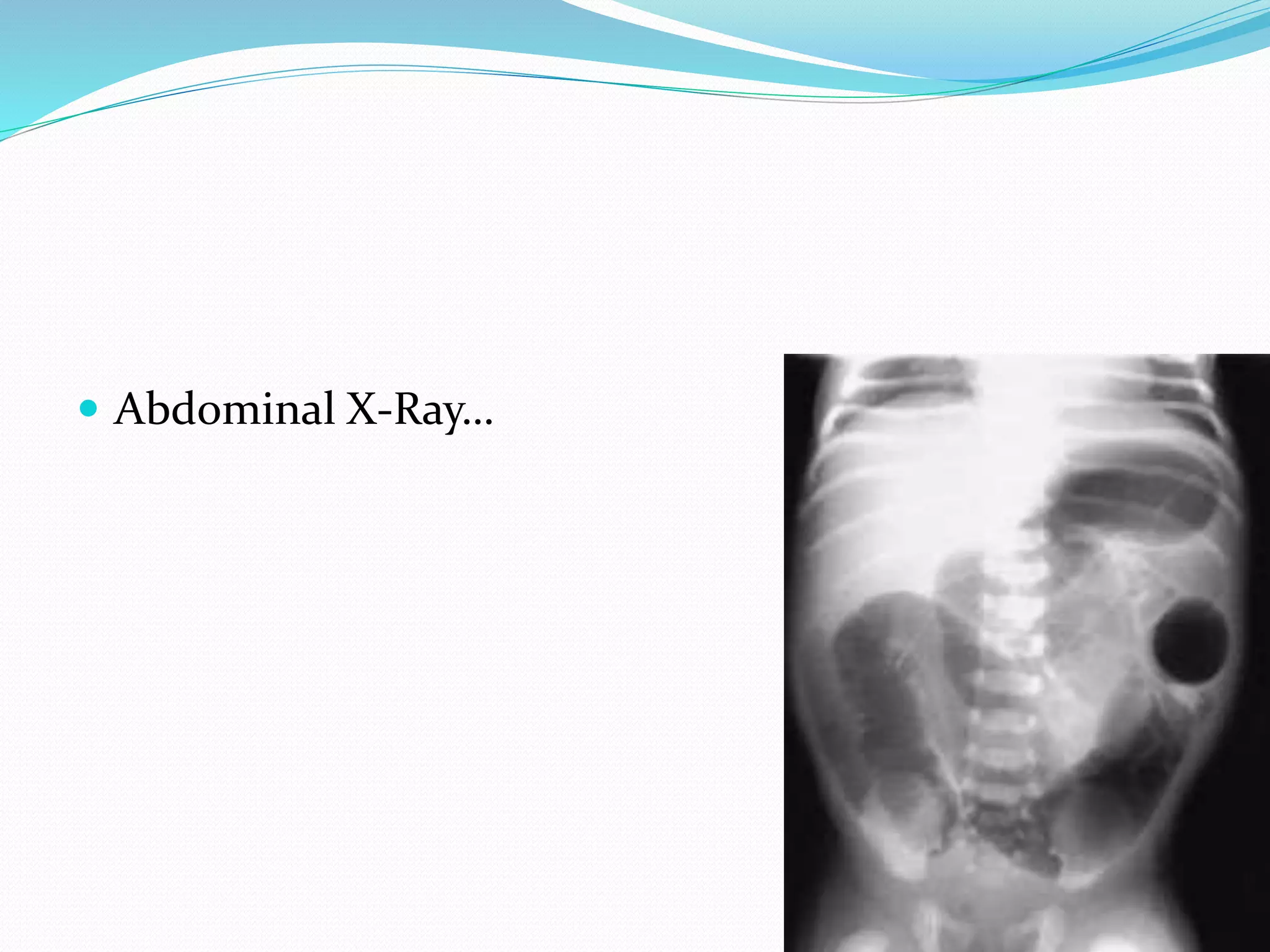  Abdominal X-Ray…
 