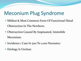 Meconium Plug Syndrome
 Mildest & Most Common Form Of Functional Distal
Obstruction In The Newborn.
 Obstruction Caused By Inspissated, Immobile
Meconium.
 Incidence 1 Case In 500 To 1,000 Neonates.1
 Etiology Is Unclear.
 