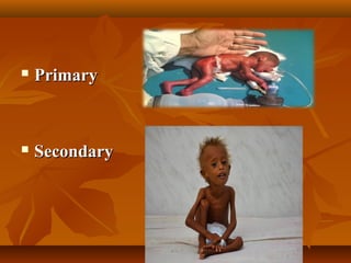  PrimaryPrimary
 SecondarySecondary
 