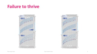 Failure to thrive
Your Date Here Your Footer Here 3
 