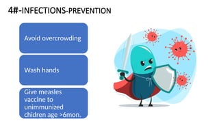 4#-INFECTIONS-PREVENTION
Avoid overcrowding
Wash hands
Give measles
vaccine to
unimmunized
chidren age >6mon.
 