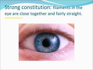 Strong constitution:  filaments in the eye are close together and fairly straight. www.drnudelman.ca 