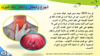 ‫سنة‬ ‫يف‬2013‫من‬ ‫شديد‬ ‫خوف‬ ،‫فوبيا‬ ‫مرض‬ ‫وبعد‬ ،
‫الث‬ ‫فقدان‬ ‫إىل‬ ‫أدت‬ ‫شرقة‬ ‫عن‬ ‫جنم‬ ،‫الشرب‬ ‫أو‬ ‫األكل‬‫يف‬ ‫قة‬
‫واألكل‬ ‫التنفس‬ ‫تنظم‬ ‫اليت‬ ‫الطبيعية‬ ‫العملية‬،‫الشرب‬ ‫أو‬
‫فم‬ ‫يف‬ ‫ماء‬ ‫جرعة‬ ‫أو‬ ‫لقمة‬ ‫وضعت‬ ‫كلما‬‫كنت‬‫حبيث‬‫إال‬ ‫ي‬
‫أختنق‬ ‫أن‬ ‫خمافة‬ ‫الفور‬ ‫على‬ ‫ولفظتها‬.‫أك‬ ‫فقدت‬‫من‬ ‫ثر‬
‫اش‬‫ر‬‫الف‬ ‫مالزمة‬ ‫إىل‬ ‫حلظات‬ ‫يف‬ ‫ووصلت‬ ‫وزِن‬ ‫نصف‬‫وانتظار‬
‫املوت‬.‫وقمت‬ ‫االختصاصيني‬ ‫األطباء‬ ‫من‬ ‫عددا‬ ‫زرت‬
‫خمتلفة‬ ‫بكشوفات‬.‫ا‬ ‫فقط‬ ‫وجود‬ ‫على‬ ‫الكل‬ ‫أمجع‬‫لتهاابت‬
‫لاللتهاب‬ ‫مضادات‬ ‫تقدمي‬ ‫مع‬ ،‫ابحللق‬..‫مضادات‬،
‫إىل‬ ‫َتتاج‬ ‫ألهنا‬ ‫أتناوهلا‬ ‫أن‬ ‫أقدر‬ ‫مل‬ ،‫ية‬‫ر‬‫للسخ‬‫أو‬ ‫البلع‬
‫االحتساء‬.
187
‫الموت‬ ‫ملك‬ ‫وانتظار‬ ‫والعطش‬ ‫الجوع‬
*‫كت‬ ‫من‬ ‫صفحات‬ ‫عدة‬ ‫سيشغل‬ ‫فذلك‬ ،‫وبخاتمتها‬ ‫المرض‬ ‫وتطور‬ ‫بمقدماتها‬ ،‫هللا‬ ‫بحول‬ ‫أكتبها‬ ‫قد‬‫صغير‬ ‫يب‬
 