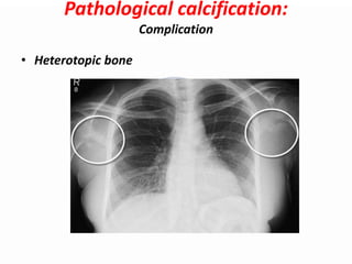 Pathologic Stones Fa1zanS: Disorder of exchange of Chromoprotein (endogenous pigment ...