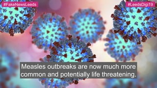 Measles outbreaks are now much more
common and potentially life threatening.
#FakeNewsLeeds #LeedsDigi19
 