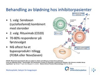 1. valg: Sendoxan (cyclofosfamid) kombinert med steroider 2. valg: Rituximab (CD20) 70-80% responderer på førstevalget Må oftest ha et bypassprodukt i tillegg (FEIBA eller NovoSeven) Rikshospitalet, Seksjon for koagulasjon Behandling av blødning hos inhibitorpasienter FIGUR: Rituximab-opsonized B cells are subject to attack and killing by at least three pathways. From the following article: ”Drug Insight: the mechanism of action of rituximab in autoimmune disease—the immune complex decoy hypothesis” by  Ronald P Taylor and Margaret A Lindorfer -  Nature Clinical Practice Rheumatology  (2007)  3 , 86-95 