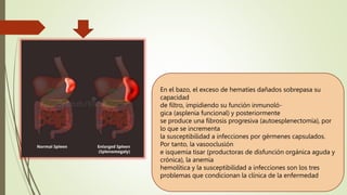 En el bazo, el exceso de hematíes dañados sobrepasa su
capacidad
de filtro, impidiendo su función inmunoló-
gica (asplenia funcional) y posteriormente
se produce una fibrosis progresiva (autoesplenectomía), por
lo que se incrementa
la susceptibilidad a infecciones por gérmenes capsulados.
Por tanto, la vasooclusión
e isquemia tisar (productoras de disfunción orgánica aguda y
crónica), la anemia
hemolítica y la susceptibilidad a infecciones son los tres
problemas que condicionan la clínica de la enfermedad
 