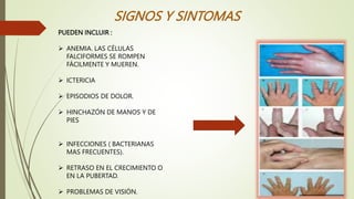 SIGNOS Y SINTOMAS
PUEDEN INCLUIR :
 ANEMIA. LAS CÉLULAS
FALCIFORMES SE ROMPEN
FÁCILMENTE Y MUEREN.
 ICTERICIA
 EPISODIOS DE DOLOR.
 HINCHAZÓN DE MANOS Y DE
PIES
 INFECCIONES ( BACTERIANAS
MAS FRECUENTES).
 RETRASO EN EL CRECIMIENTO O
EN LA PUBERTAD.
 PROBLEMAS DE VISIÓN.
 