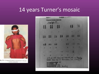 14 years Turner’s mosaic
 