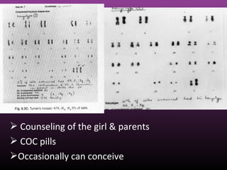  Counseling of the girl & parents
 COC pills
Occasionally can conceive
 