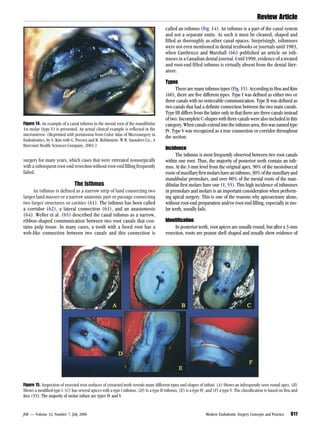 Modern Endodontic surgery - modern techniques | PDF