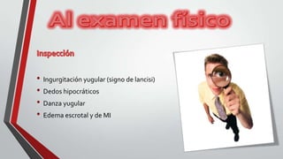 • Ingurgitación yugular (signo de lancisi)
• Dedos hipocráticos
• Danza yugular
• Edema escrotal y de MI
 