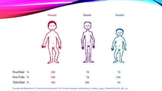 Tomado deWaterlow JC: Nutrition and growth. En: Protein energy malnutrition, London, 1992, EdwardArnold, 187-211
 