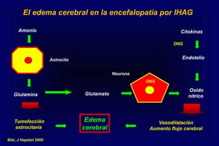 El edema cerebral en la encefalopatía por IHAG
Amonio
Astrocito
Glutamina
Tumefacción
astrocitaria
ONS
Glutamato
Oxido
nítrico
Vasodilatación
Aumento flujo cerebral
Citokinas
Endotelio
ONS
Neurona
Edema
cerebral
Blei, J Hepatol 2000
 
